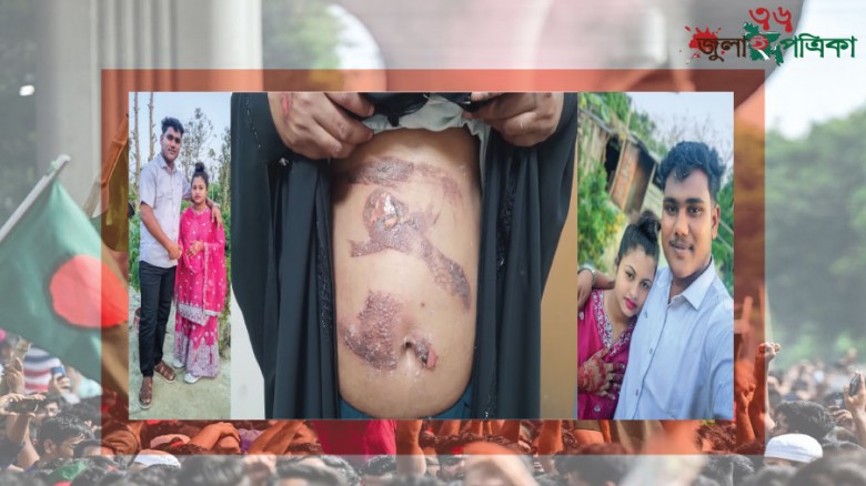 মাটিরাঙ্গায় স্বামীর দেয়া আগুনে ঝলসে গেছে স্ত্রীর শরীর